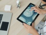 Doctor examining brain scan on tablet at desk.